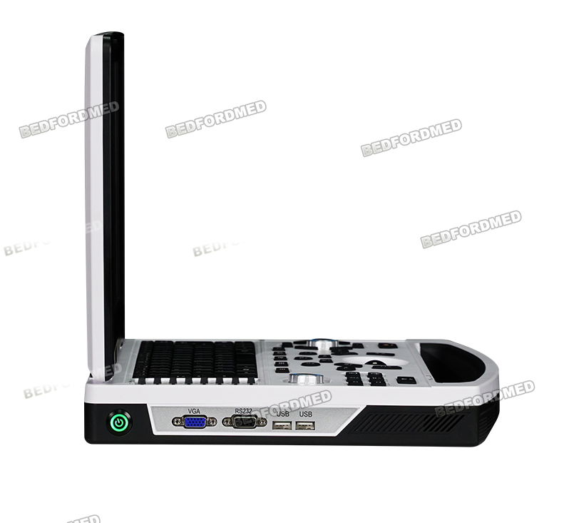 Hospital Surgical Intelligent Laptop Ultrasound Diagnostic System Me-690 Y3.0