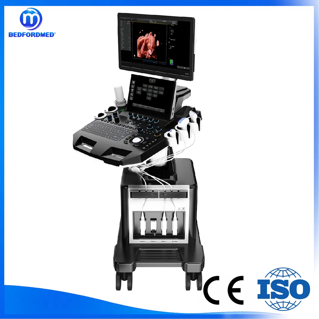 Ultrasonic Diagnostic System Full View