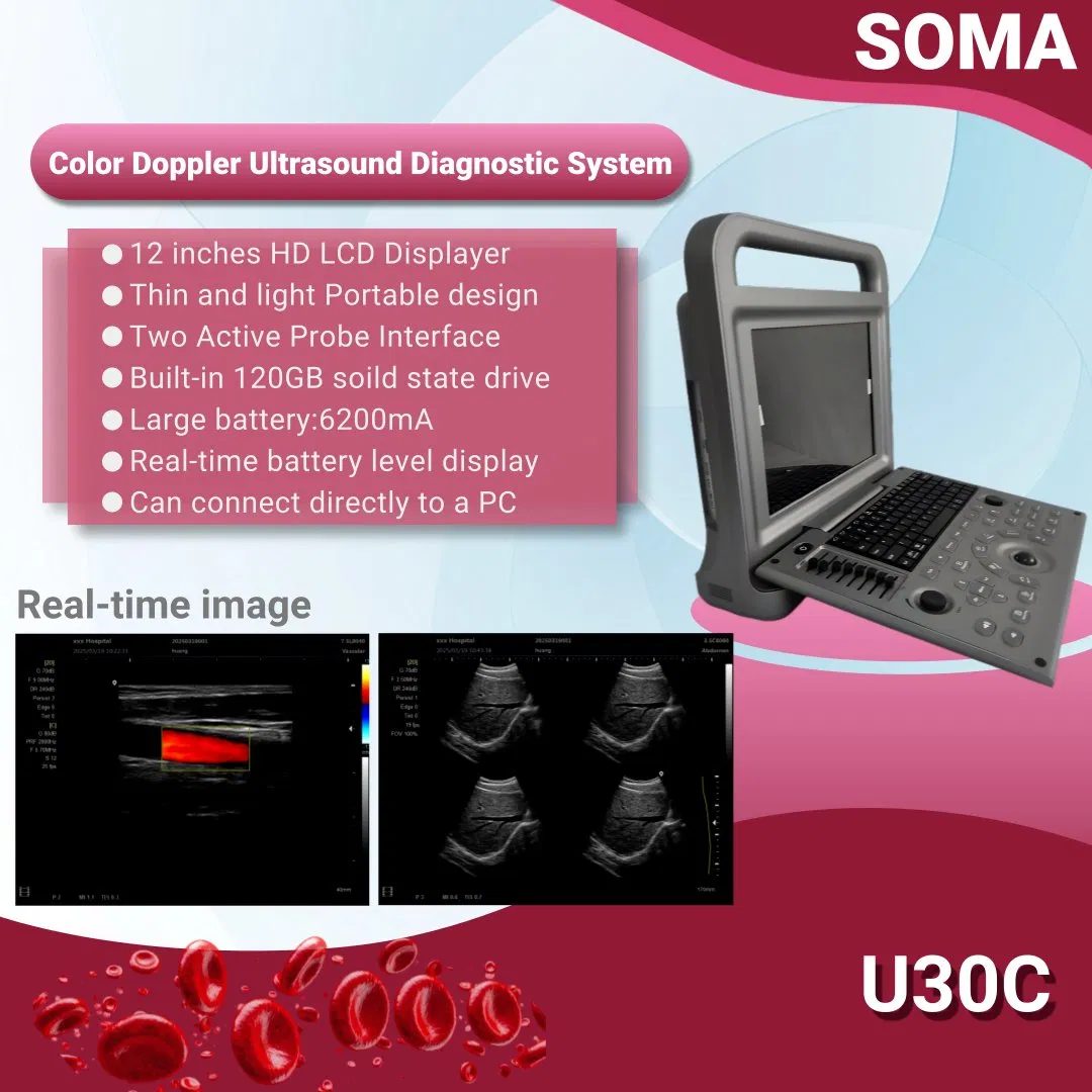 U30c Portable 12.1-Inch High Resolution Display Screen Color Doppler Ultrasonic Diagnostic System