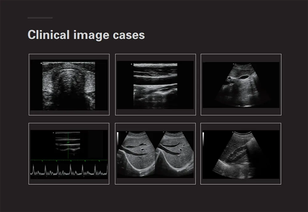 Ultrasound System View 3