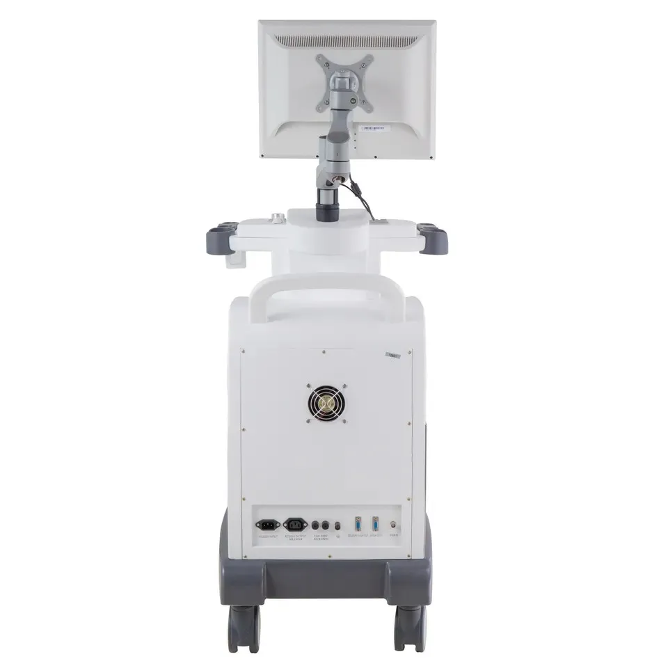 Ultrasound System View 3