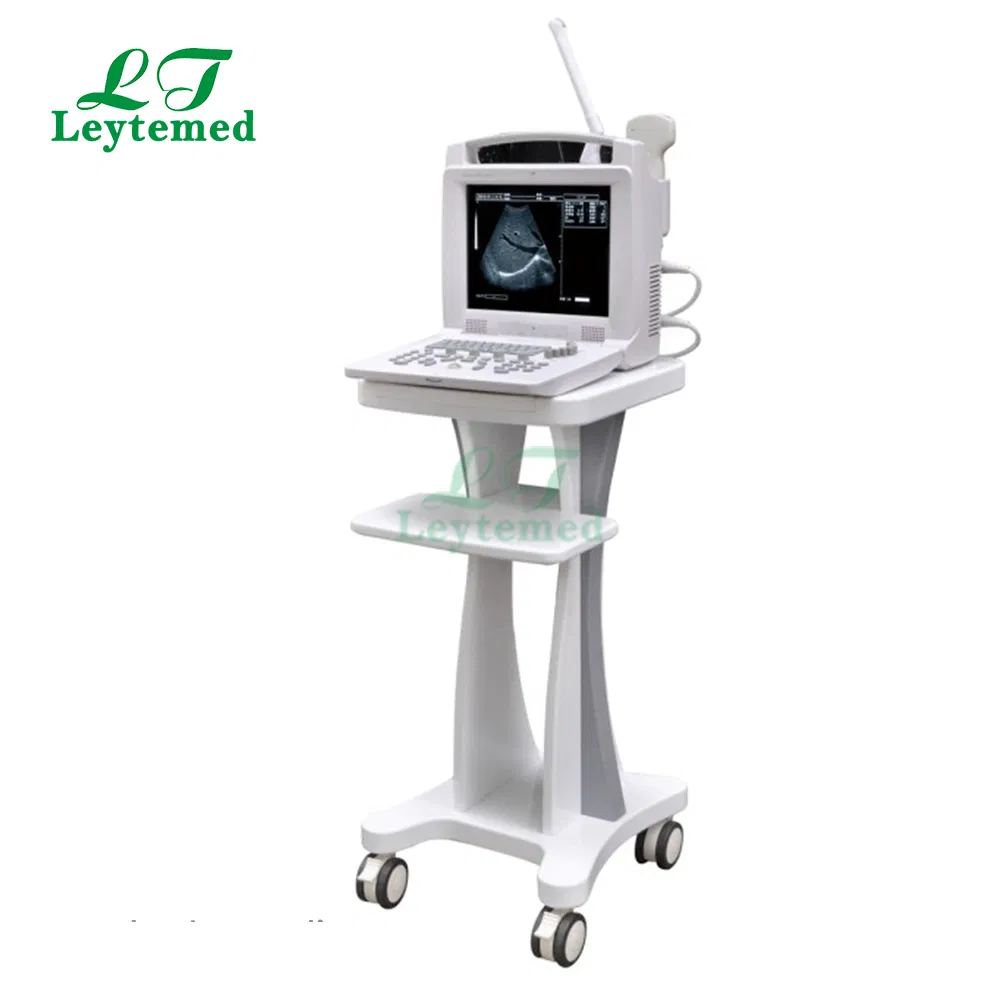 Ltub29 Portable Convex Linear Ultrasound Scanning Diagnostic Ultrasound System