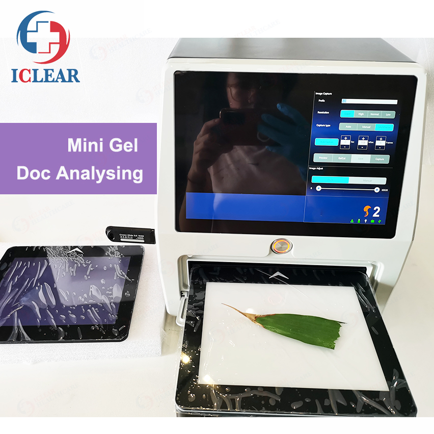 6.44 MP Automatic Mini Gel Documentation Imaging Analysis System