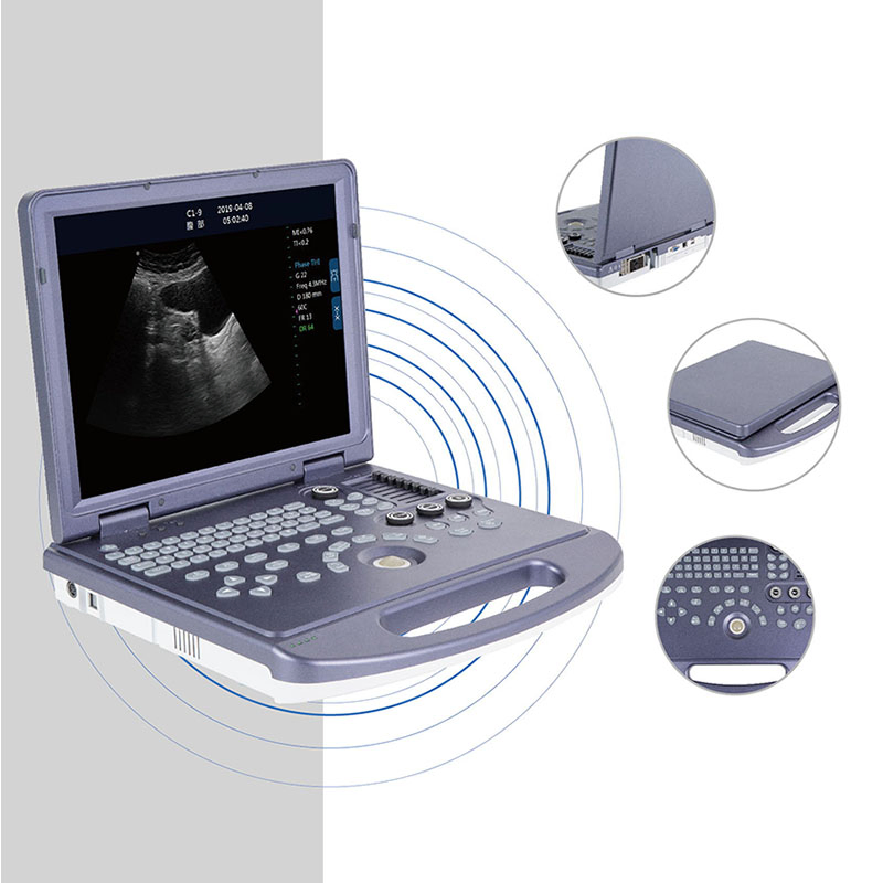Cy-Dw360 PC Platform Full-Digital Black and White Ultrasound Diagnostic Equipment
