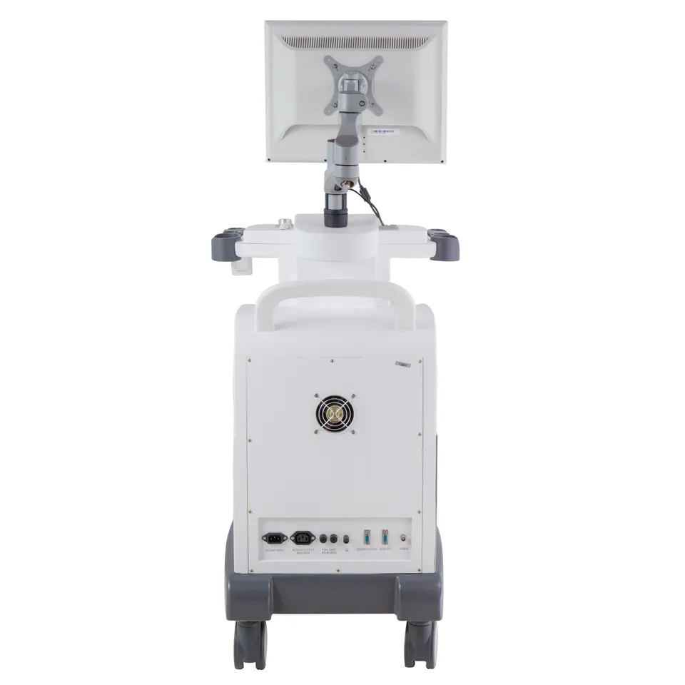 Black and White PC Platform Full-Digital Trolley Ultrasound Diagnostic System