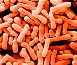 Customized Feminine Health Probiotic Solutions: 100 Billion Cfu