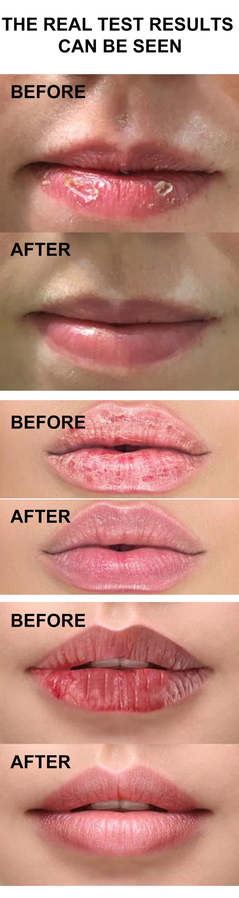 Aloe Vera Lip Balm 9