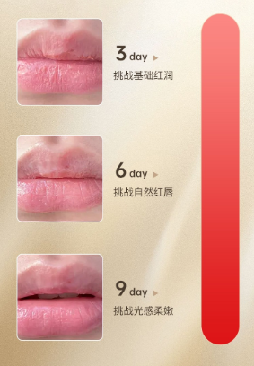 Lip treatment device 7