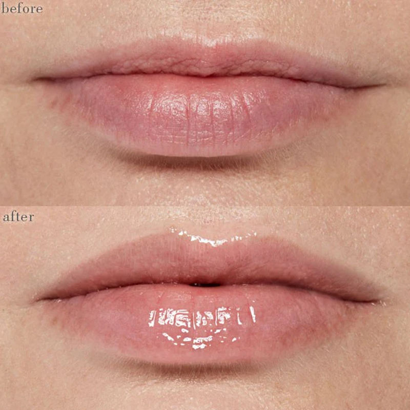OEM Custom Lip Plumping Serum Booster Syringe with New Container Vegan Liquid Hyaluronic Acid Private Label Lip Plumper