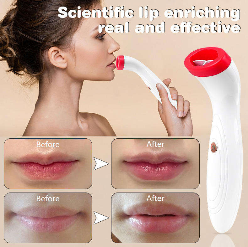 2024 New Trending Portable USB Rechargeable Electric Lip Plumper Device Skin Care Tools Lip Plumping Equipment