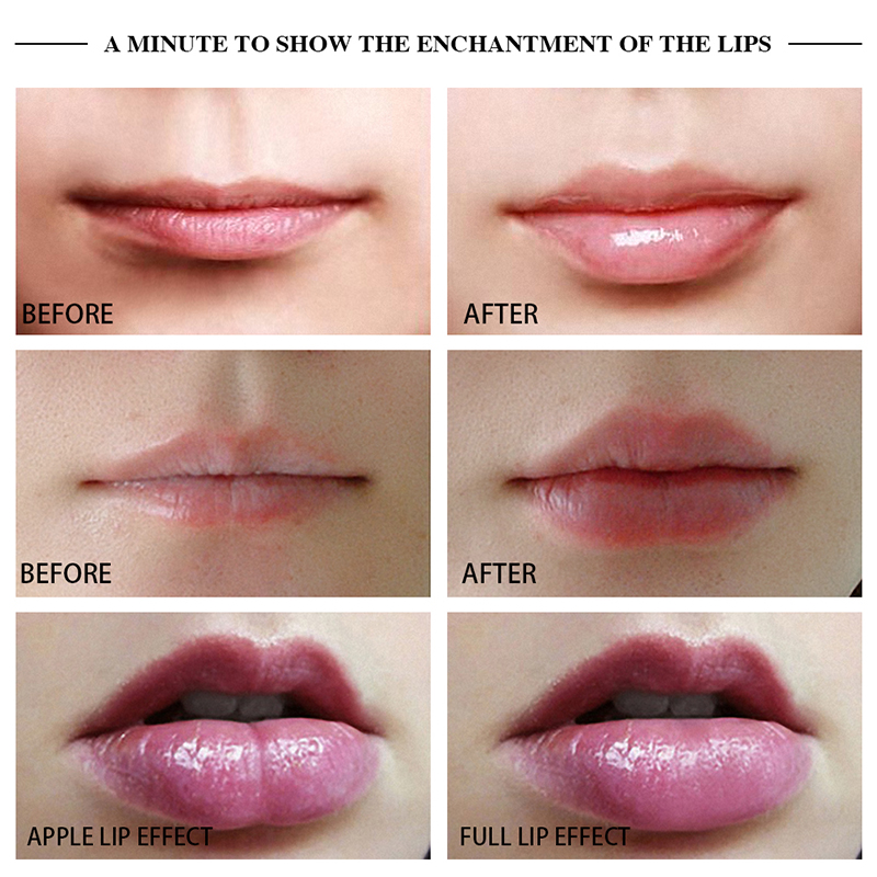 Apple &amp; Full Two Types Lip Plumper Enhancer Lip Enhancer Machine