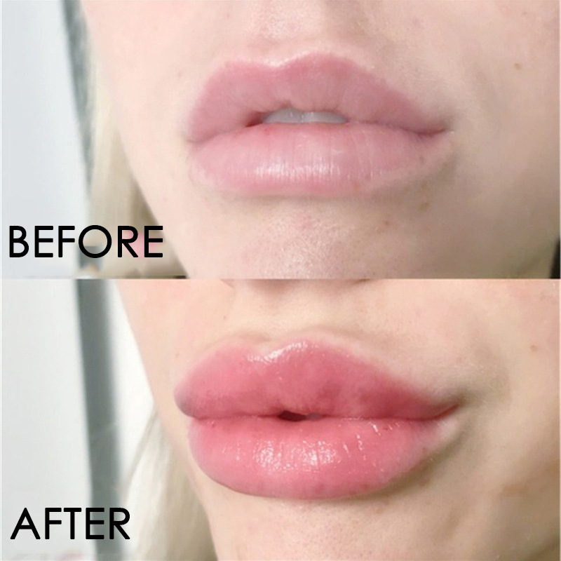 Lip Product 2