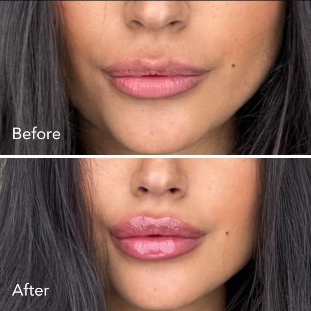 Custom Organic Vegan Lip Volumizer Extreme Tingle Burn Whitening Lip Plumper with Private Peptides Shea Butter Niacinamide