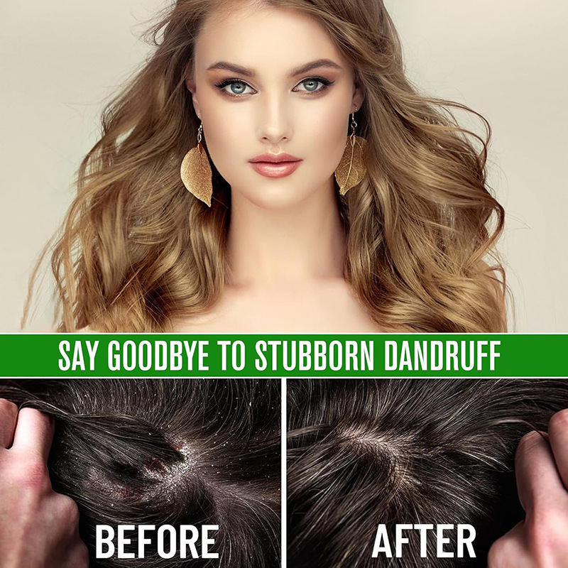 Organic Hair Growth Serum With Herbal &amp; Tea Tree Oil Encourages Scalp Skincare Private Label Hair Oils for Hair Loss Prevention