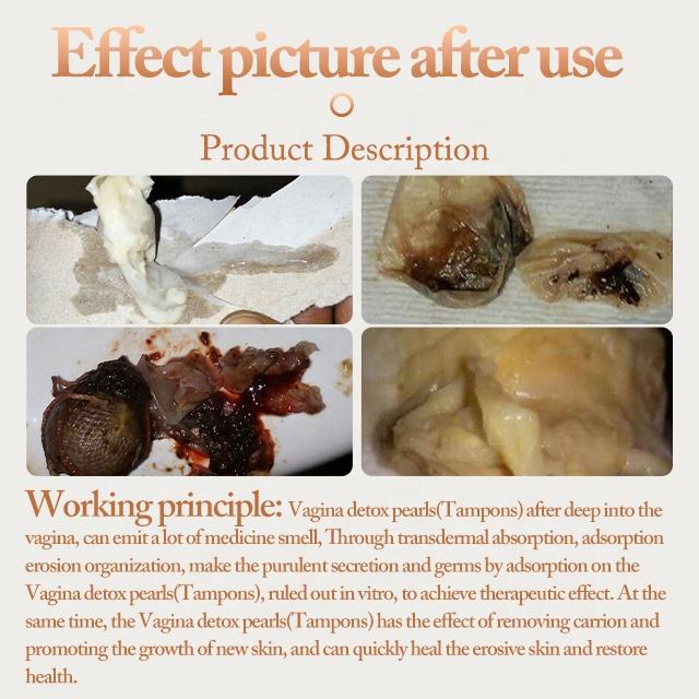 Wholesale 100% Natural Herbal Formula Intimate Care Original YONI Pearl Detoxifying Intimate Cleansing And Spot Treatment