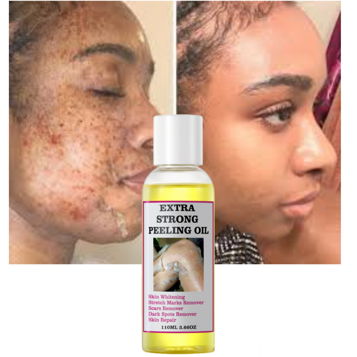 OEM Yellow Peeling Oil Vitamin C Vitamin E Knuckle Whitening Moisturizing Dark Spot Removal Extra Strength Peeling Oil