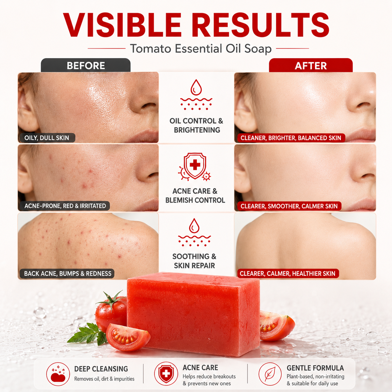 Private Label Korea Organic Skin Care Tea Tree Face Soap Bar Anti-Acne &amp; Anti-Aging for Dry Skin Women Herbal Ingredients