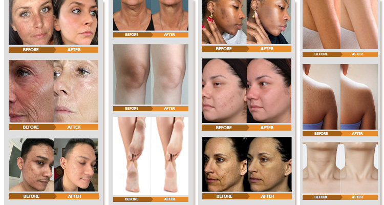 Turmeric product close up 4