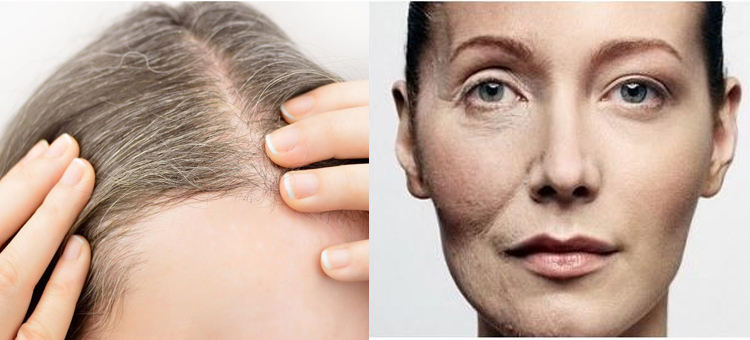 Hair Care Natural Chinese Herbs Plant 1: 1 4: 1 5: 1 10: 1 20: 1 Polygonum Multiflorum Extract