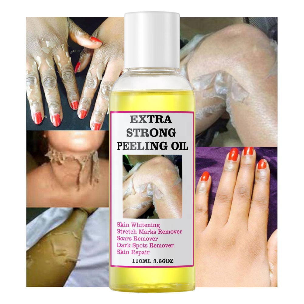 OEM Yellow Peeling Oil Vitamin C Vitamin E Knuckle Whitening Moisturizing Dark Spot Removal Extra Strength Peeling Oil