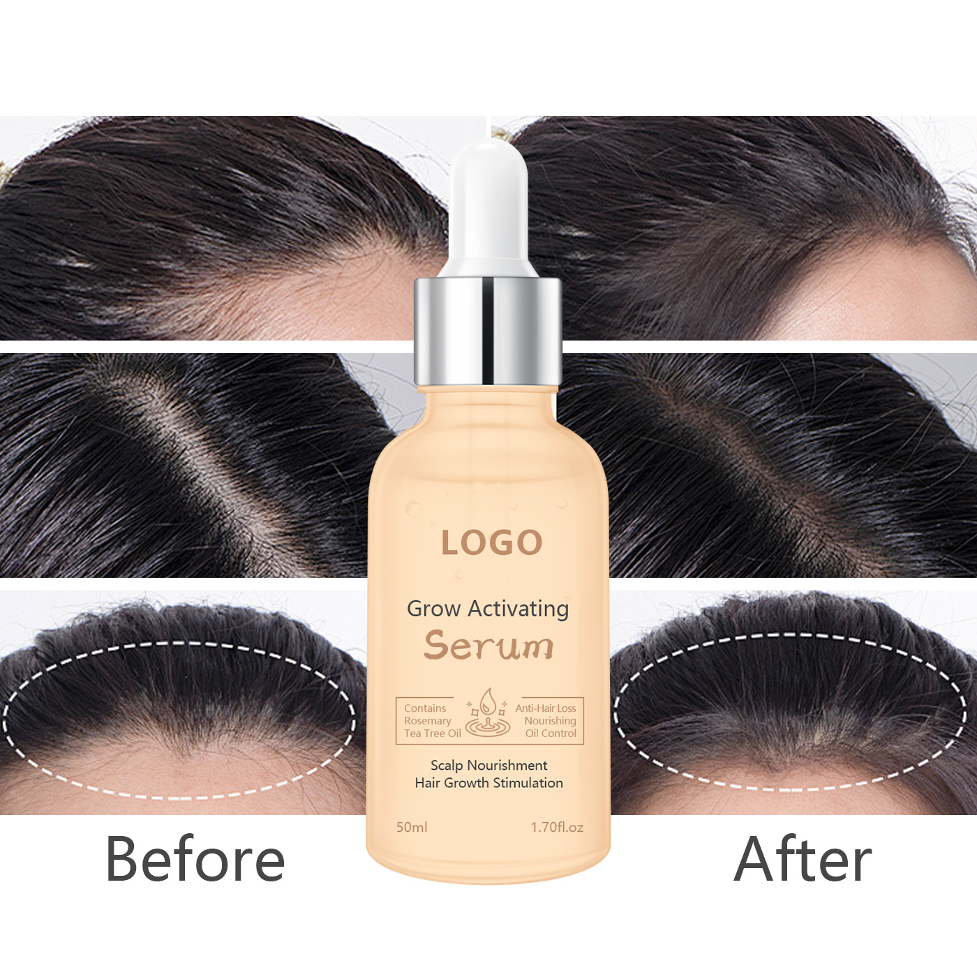 Factory-Customized Natural Rosemary &amp; Organic Tea Tree Oil Hair Growth Serum For Hair Regrowth And Scalp Nourishment