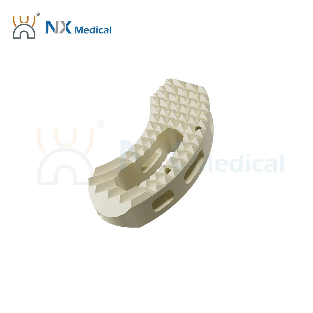 Nx Medical OEM Support Tlif Cage Peek Titanium for Lumbar Interbody Fusion