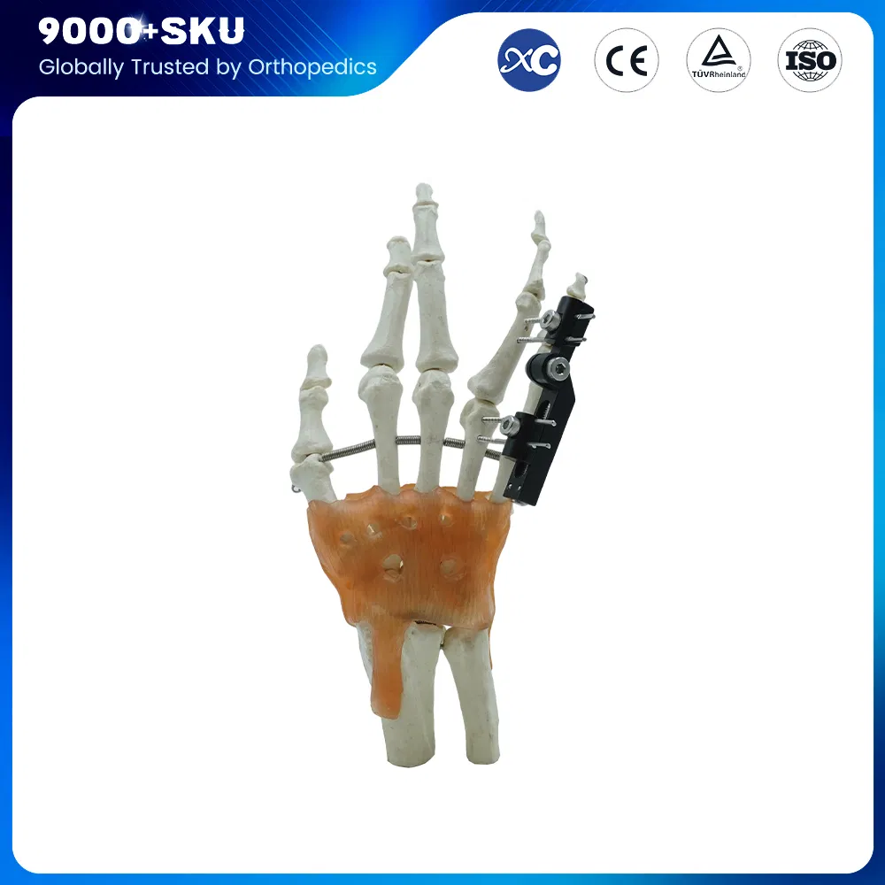 Orthopedic Surgery Trauma Manufacturer Finger External Fixator for Mini Fixator