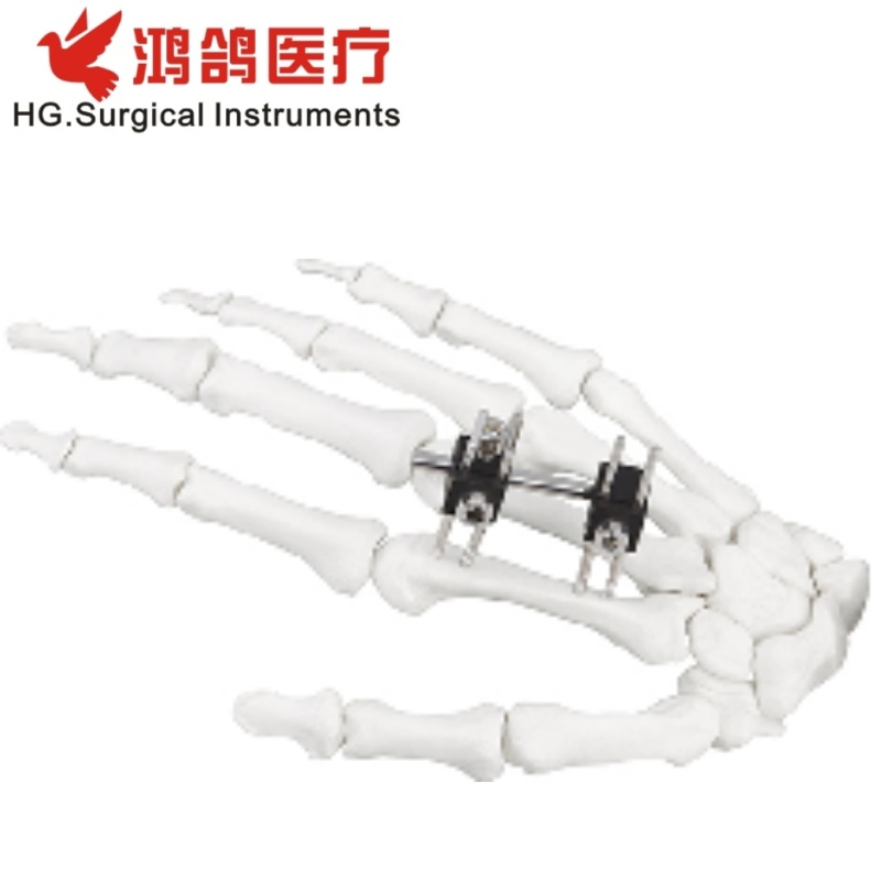 Orthopedic Mini Fixator Joint Motion Type Orthopedic External Orthopedic Products Orthopedic Instrument