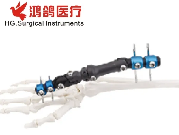 Orthopedic Mini Fixator