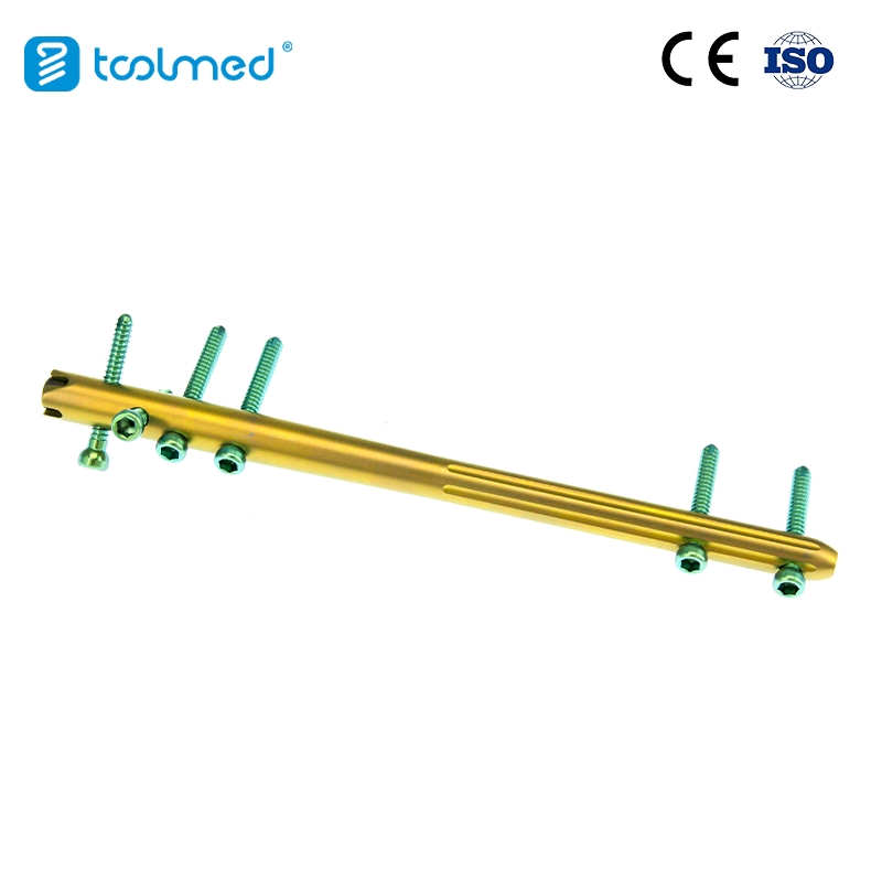 Orthopedic Fixation with Retrograde Intramedullary Femur Interlocking Intramedullary Nails 11*200