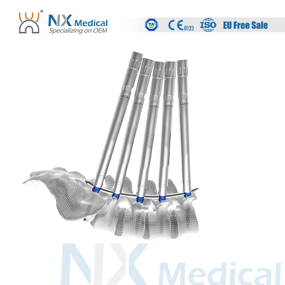 Nx Medical Titanium Cannulated Bone Cement Pedicle Screw Orthopedic Internal Fixation