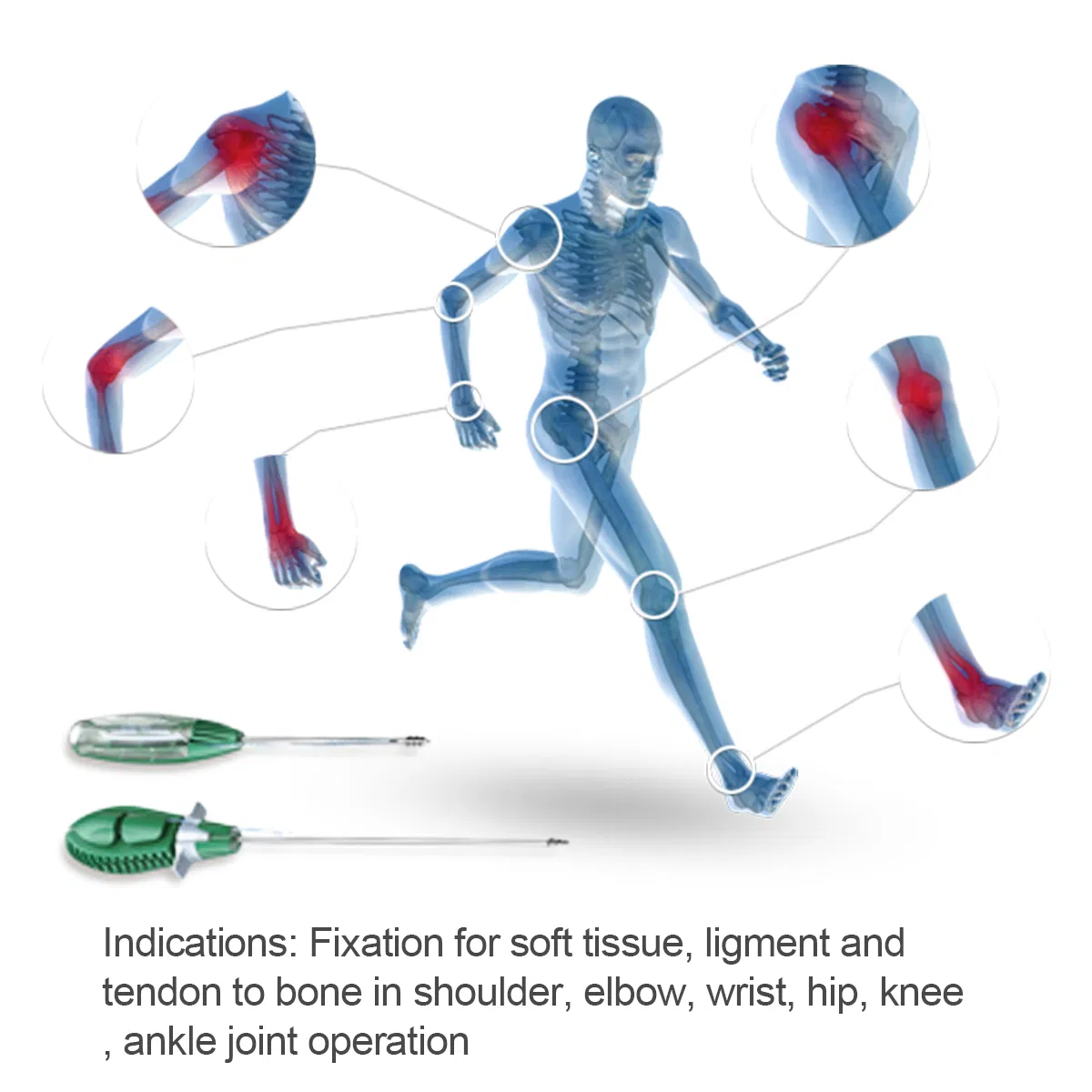 Sport Medicine Non-Absorbable Suture Ancho Joint Repair Titanium Alloy Suture Anchor