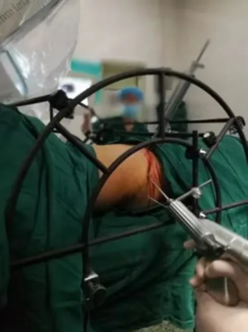 Surgical Setup