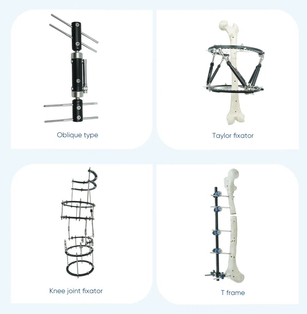 Xc Medico Orthopedic Medical Device Bone Fixation Tibia and Femur External Fixator