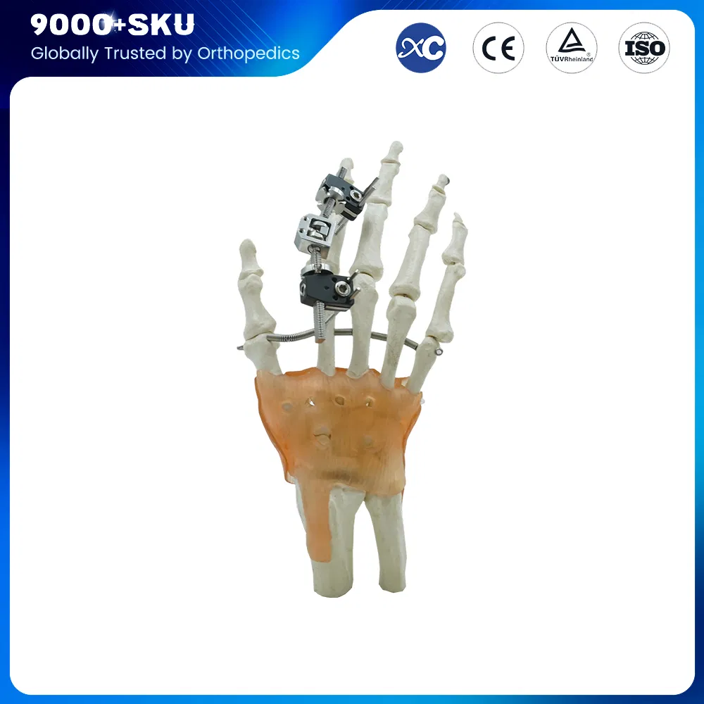 Orthopedic Surgery Trauma Manufacturer Finger External Fixator for Mini Fixator