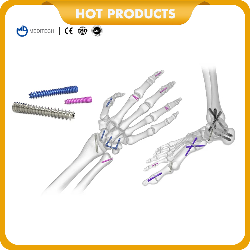 Orthopedic Implants Titanium Medical Bone Screws Cannulated Headless Compression Screw