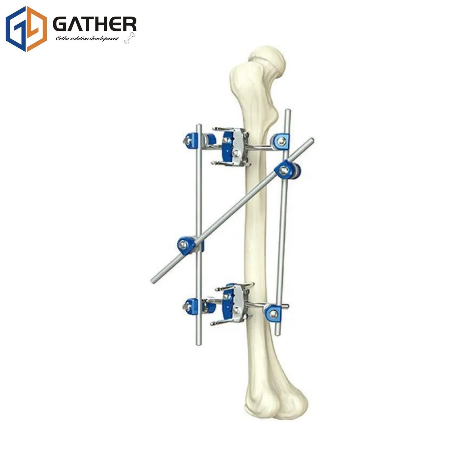 Customized Sterilized Package Stainless Gather Biotech Carbon Fiber Surgical Instrument Fixation External Fixator