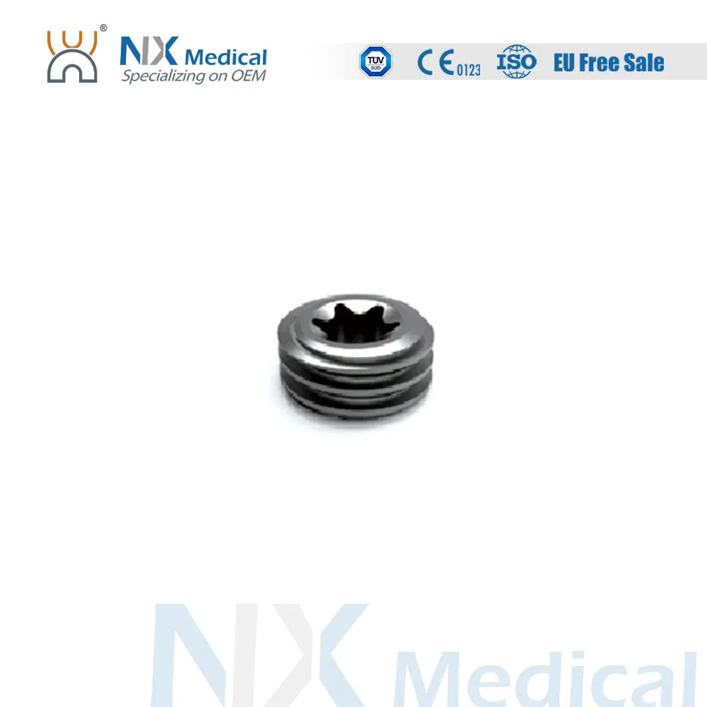 Nx Medical Advanced Sf-IV Mis Cannulated Bone Cement Spinal Pedicle Screw 5.5mm