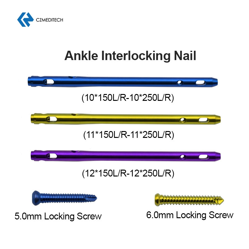 Hindfoot Fusion Ankle Intramedullary Nail Titanium Interlocking Nail Exporters Hospital Surgical Equipment