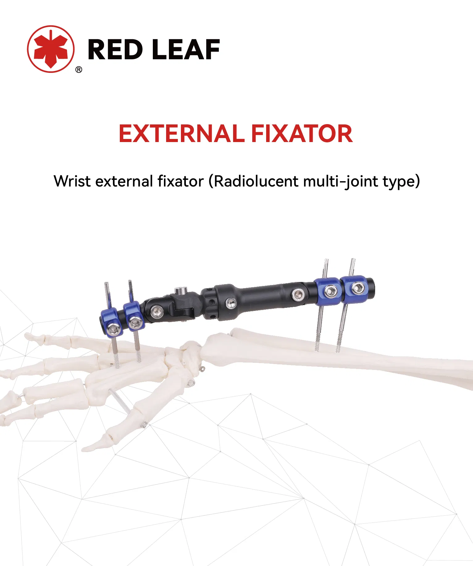 Orthopedic Fixation Radiolucent Multi-Joint Type External Fixator