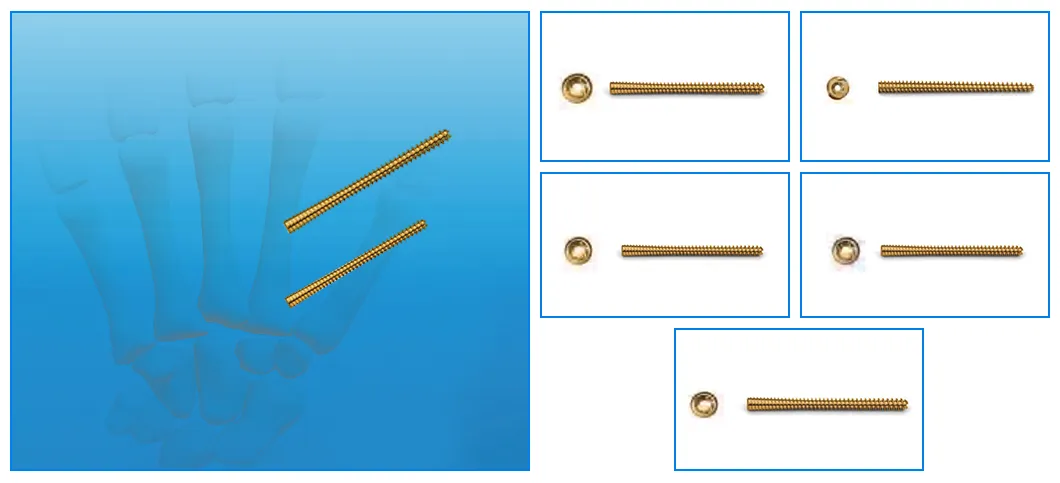 Compression Screw Mechanism