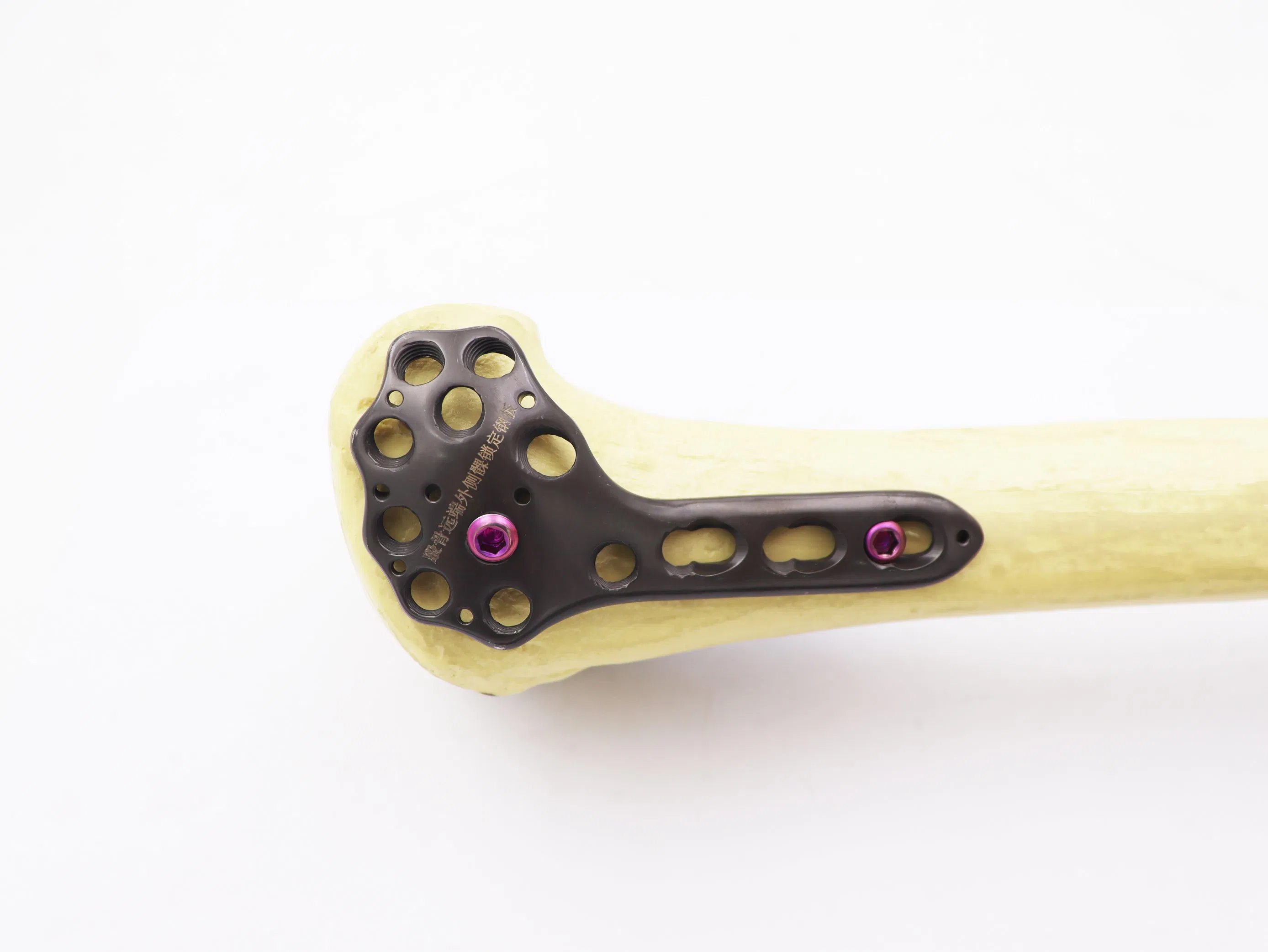 Titanium Plate Implant Price Surgical Medical Supply Orthopedic Implants Distal Femur Medial Condyle Locking Plate for Femur (L/R)