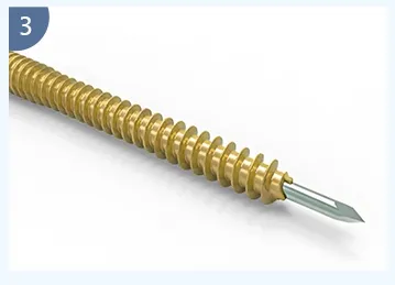 Full Threaded Stability