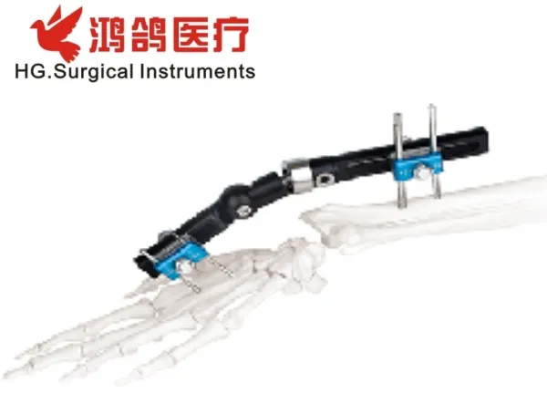 Orthopedic Mini Fixator
