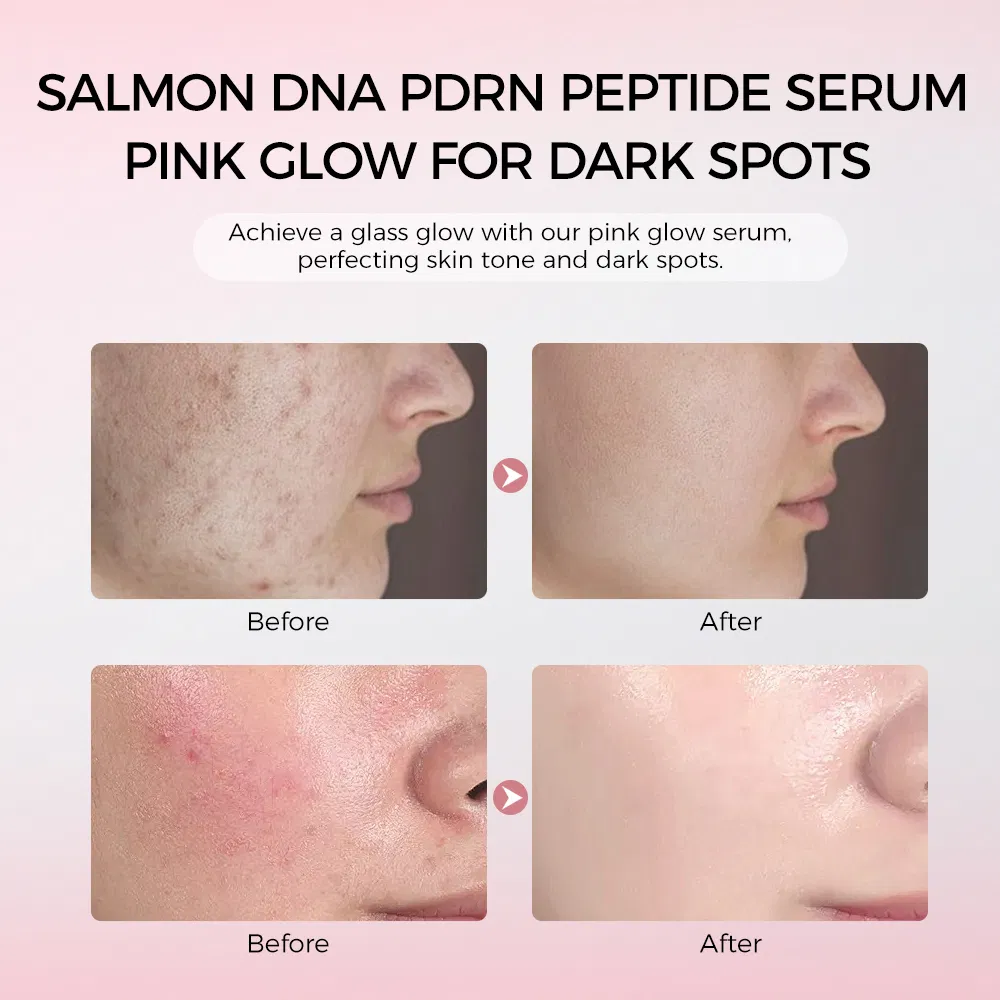 Pink Glow Glass Skin Care Serum Korean Products Whitening Collagen Copper Peptide Serum Pdrn Salmon DNA
