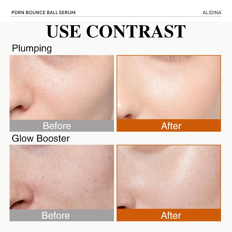 G Salmon Pdrn Bounce Ball Serum Skin Repair Redness Damaged Skin Glass Skin Lightweight Caviar Extract Niacinamide Korean Serum