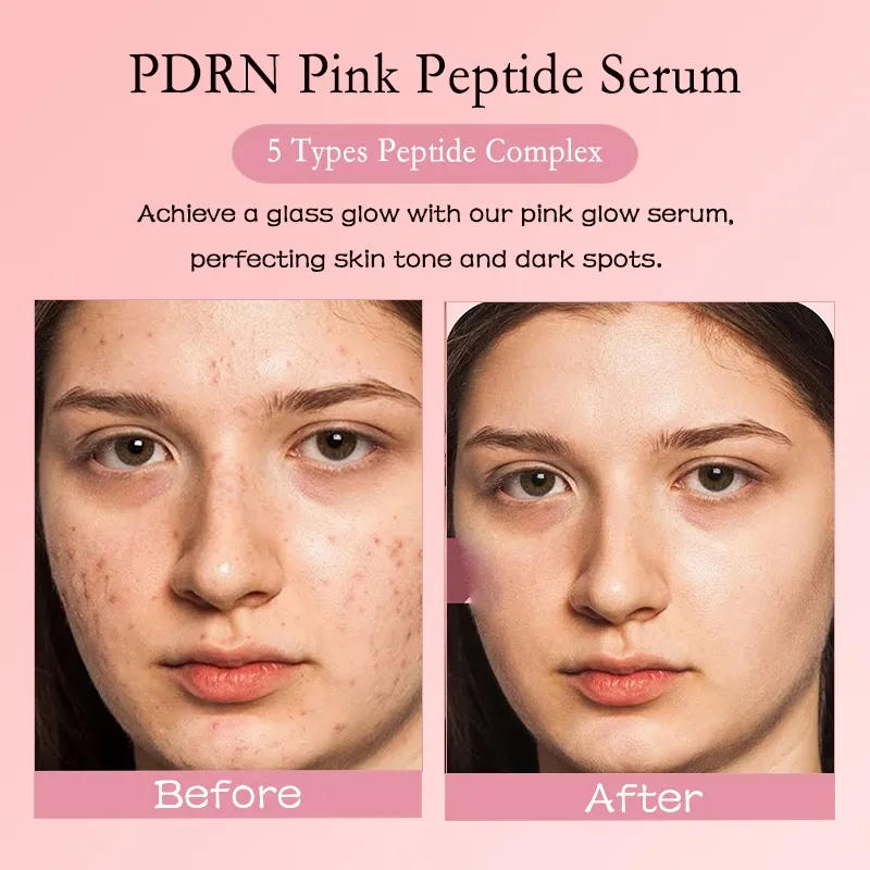 Pdrn Pink Glass Glow Serum 7