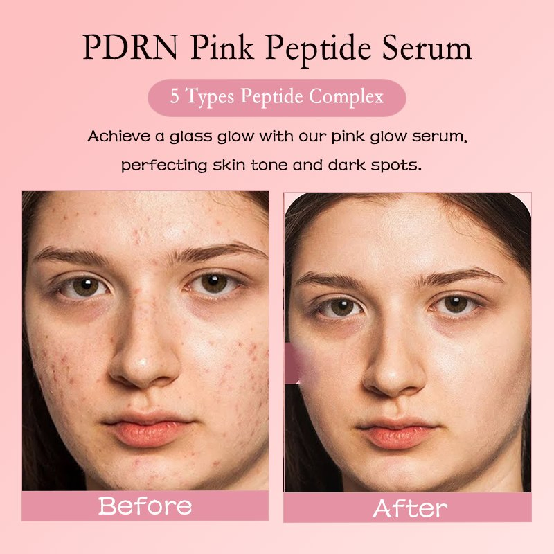G Pdrn Pink Glass Glow Serum for Moisturizer Soothing Firming Uneven Skin Tone Rose Pdrn Peptide Niacinamide Korean Skin Care
