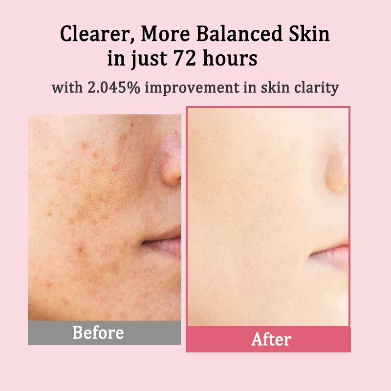 OEM 10% Niacinamide with 5% Txa Facial Serum for Glass Skin Care Clarifying Radiant Complexion Natural Color Niacinamide Serum