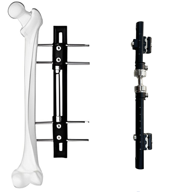 Factory Price Orthopedic Surgical Instruments Femur & Tibial External Fixator Orthopedic Surgical Implant Bone Surgery Fixation